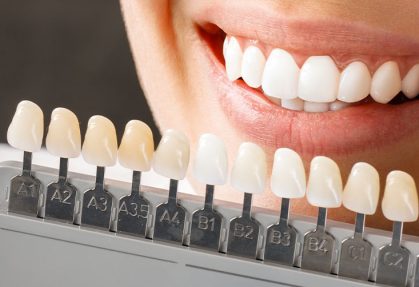 Teeth Whitening Aftercare